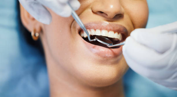 Best Emergency Dentist for Lost Fillings or Crowns in Kimberly, AL