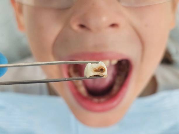 Best Broken or Cracked Tooth Emergency Dentist in Kimberly, AL